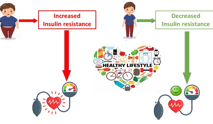 Insulin Resistance What Is It Unveiling Causes Symptoms And